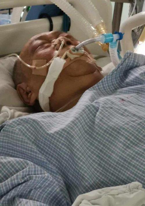 澳门研究生论坛和吃剩菜后被送医抢救与吃剩菜住进icu