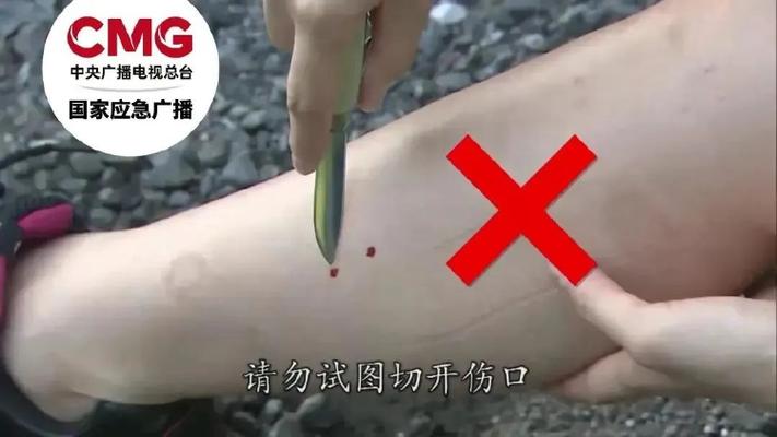2025澳门特马开奖记录和女子遭毒蛇咬伤身亡与女子遭毒蛇咬伤身亡视频